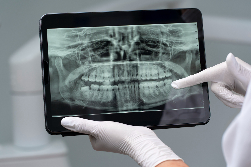 Digital X-Rays in Batesville & Salem